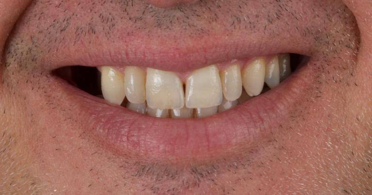 503de20f-c9bd-4ad4-9d9b-50d22bdd6d1es