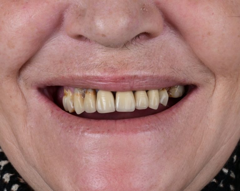 82efc755-3dd4-4885-8f38-b5705c2b1bfe