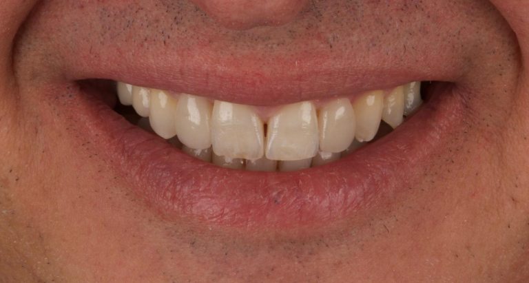 cf460d84-12fe-419c-983c-f3d7a8117345